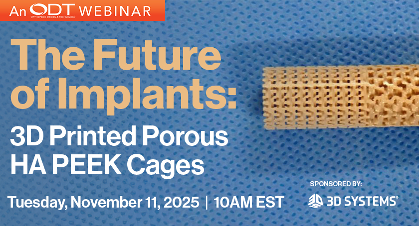 The Future of Implants: 3D Printed Porous HA PEEK Cages